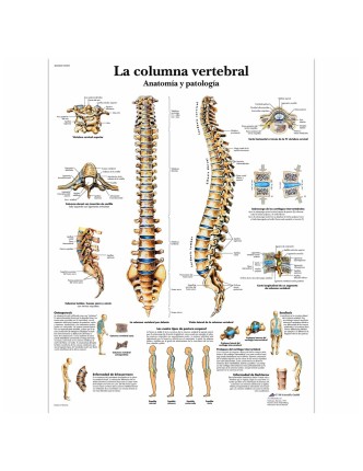 Lámina Columna Vertebral (50 x 67 cm.)